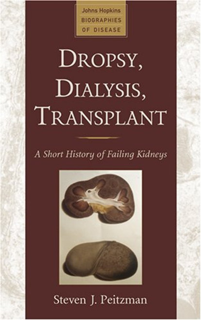 Dropsy, Dialysis, Transplant: A Short History of Failing Kidneys (Johns Hopkins Biographies of Disease)