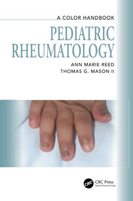 Pediatric Rheumatology: A Color Handbook (Medical Color Handbook Series)