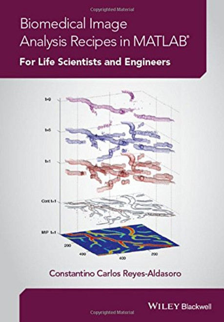 Biomedical Image Analysis Recipes in MATLAB: For Life Scientists and Engineers