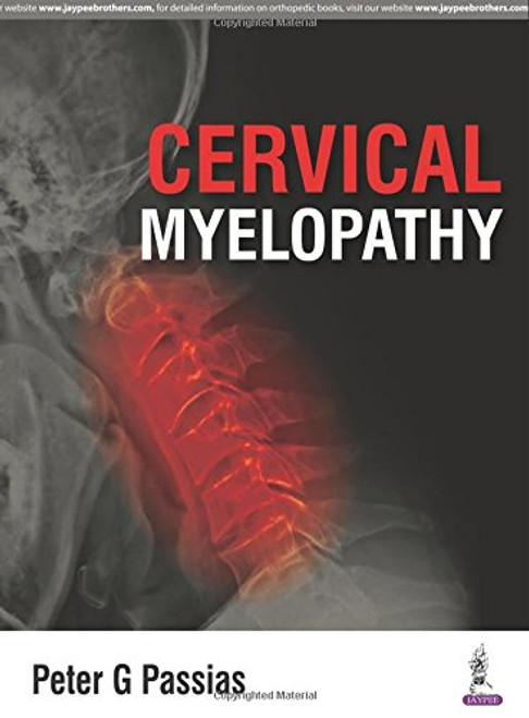 Cervical Myelopathy