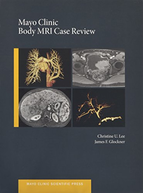 Mayo Clinic Body MRI Case Review (Mayo Clinic Scientific Press)