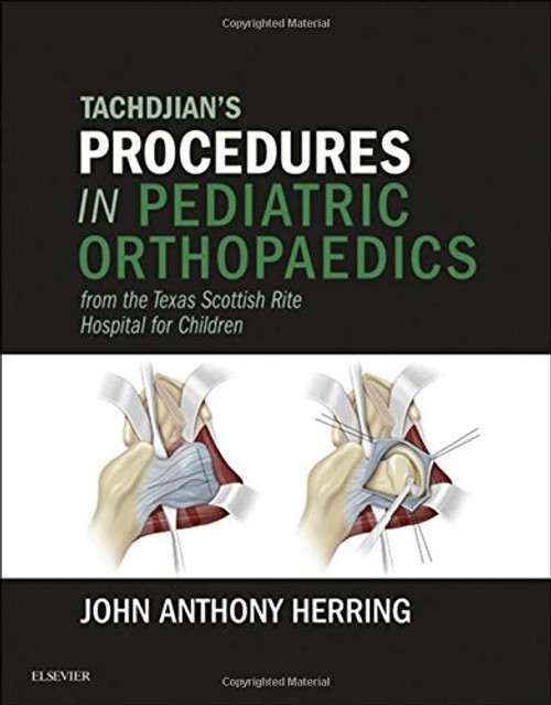 Tachdjian's Procedures in Pediatric Orthopaedics: From the Texas Scottish Rite Hospital for Children, 1e