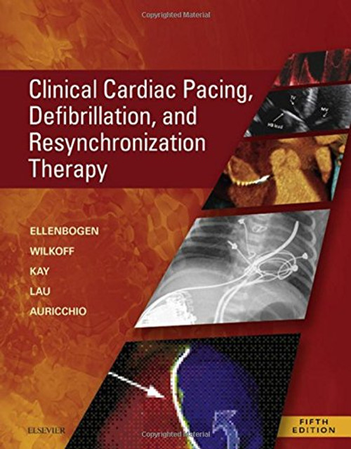 Clinical Cardiac Pacing, Defibrillation and Resynchronization Therapy, 5e