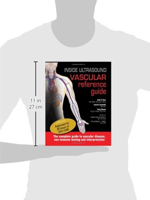 Inside Ultrasound Vascular Reference Guide