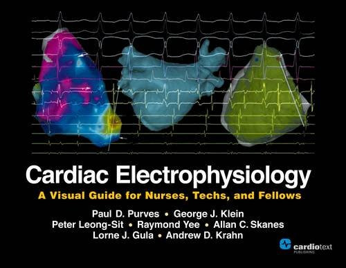 Cardiac Electrophysiology: A Visual Guide for Nurses, Techs, and Fellows