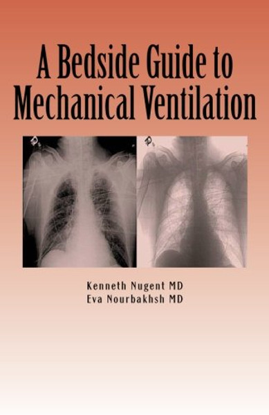 A Bedside Guide to Mechanical Ventilation