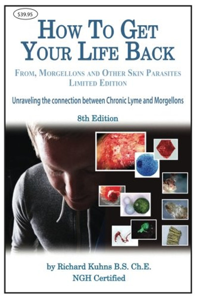How to Get Your Life Back From  Morgellons and Other Skin Parasites Limited Edit
