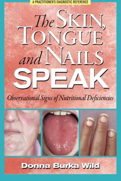 The Skin, Tongue and Nails Speak: Observational Signs of Nutritional Deficiencies