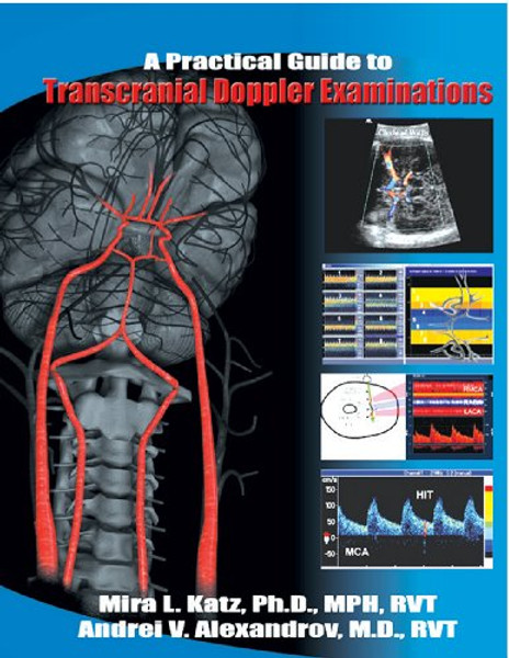 Practical Guide to Transcranial Doppler Examinations