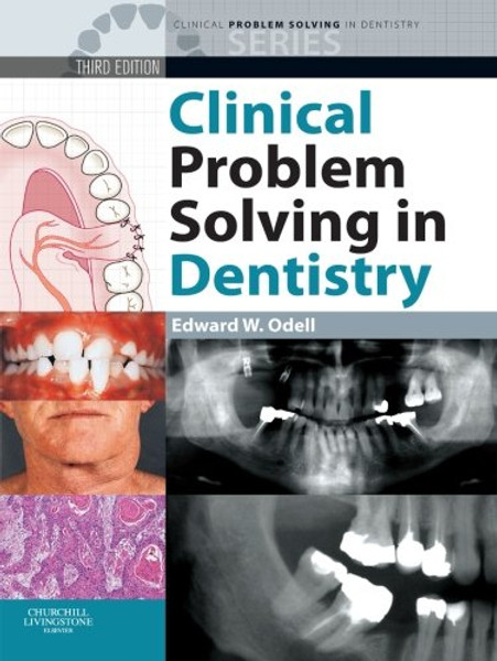 Clinical Problem Solving in Dentistry, 3e (Clinical Problem Solving in Dentistry Series)
