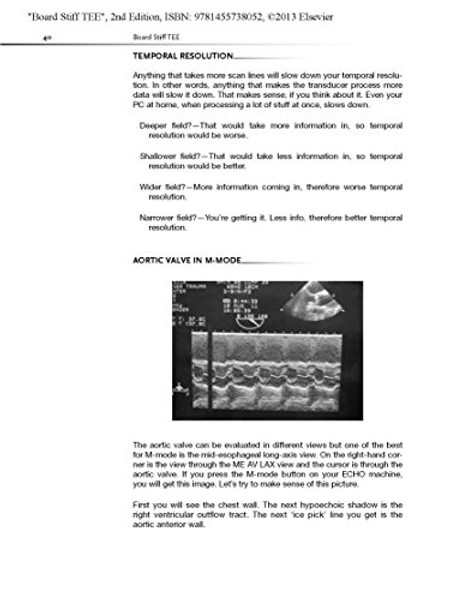 Board Stiff TEE: Transesophageal Echocardiography:  ExpertConsult Online and Print, 2e