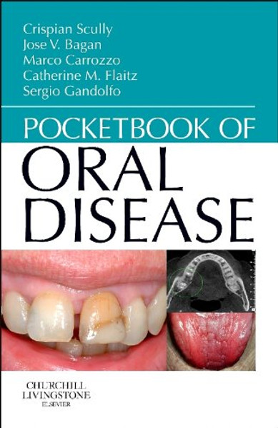 Pocketbook of Oral Disease, 1e