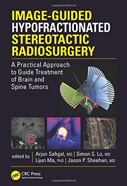 Image-Guided Hypofractionated Stereotactic Radiosurgery: A Practical Approach to Guide Treatment of Brain and Spine Tumors