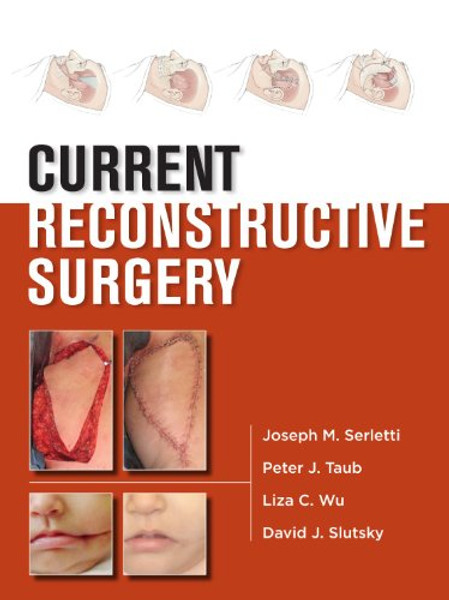 Current Reconstructive Surgery (Lange Current)