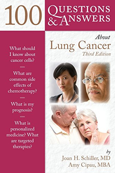 100 Questions  &  Answers About Lung Cancer (100 Questions and Answers)