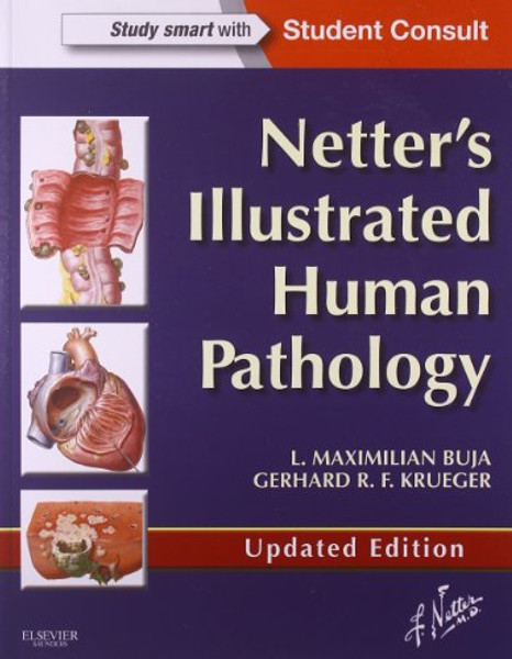 Netter's Illustrated Human Pathology Updated Edition: with Student Consult Access, 1e