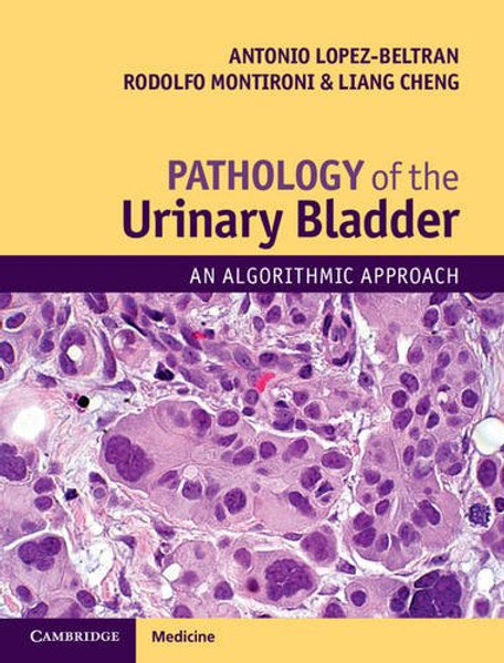 Pathology of the Urinary Bladder: An Algorithmic Approach