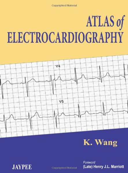 Atlas of Electrocardiography