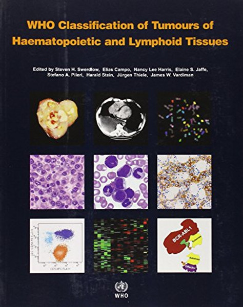 WHO Classification of Tumours of Haematopoietic and Lymphoid Tissue [OP] (IARC WHO Classification of Tumours)