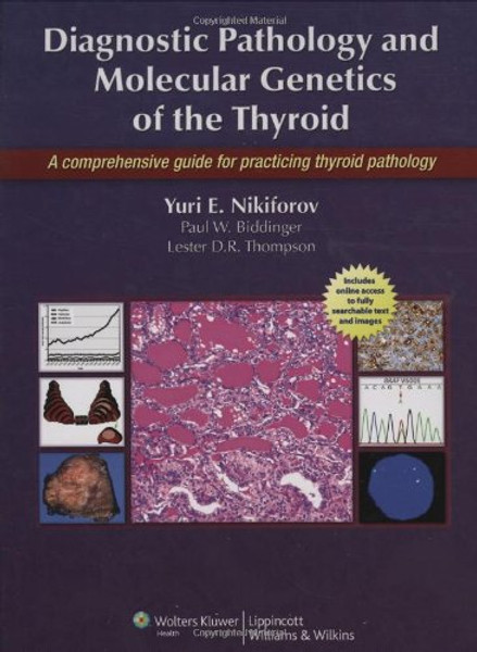 Diagnostic Pathology and Molecular Genetics of the Thyroid: A Comprehensive Guide for Practicing Thyroid  Pathology