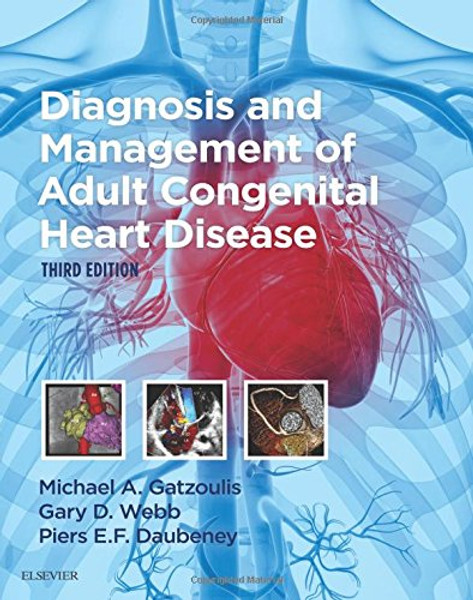 Diagnosis and Management of Adult Congenital Heart Disease, 3e