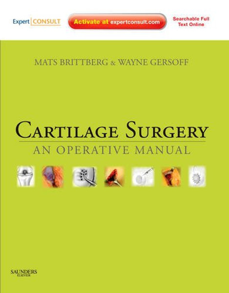 Cartilage Surgery: An Operative Manual, Expert Consult: Online and Print, 1e