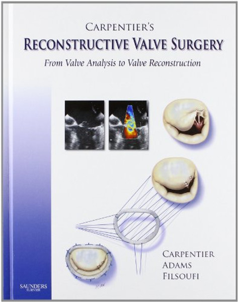 Carpentier's Reconstructive Valve Surgery, 1e