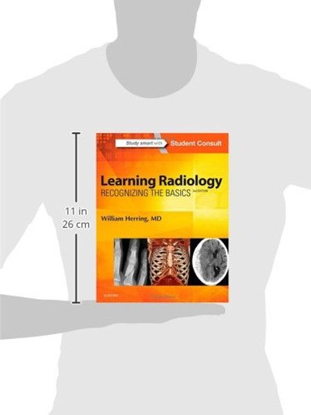 Learning Radiology: Recognizing the Basics, 3e