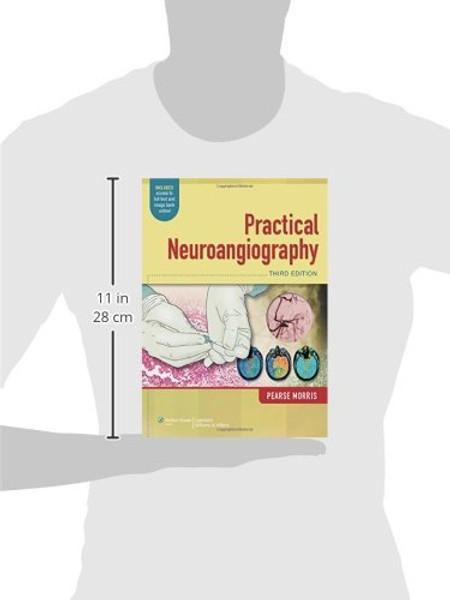 Practical Neuroangiography