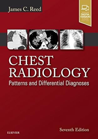 Chest Radiology