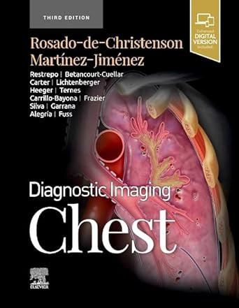 Diagnostic Imaging: Chest