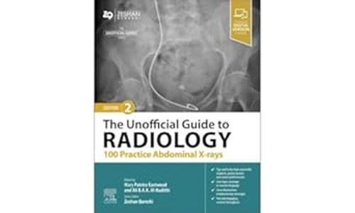 The Unofficial Guide to Radiology: 100 Practice Abdominal X-rays