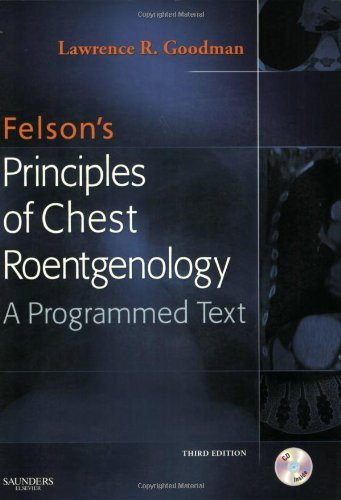 Felson's Principles Of Chest Roentgenology