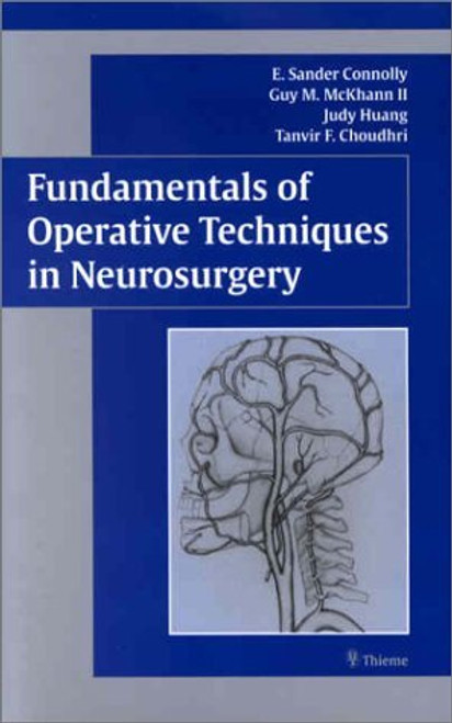 Fundamentals Of Operative Techniques In Neurosurgery