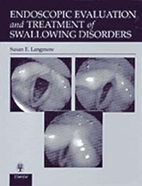 Endoscopic Evaluation and Treatment of Swallowing Disorders