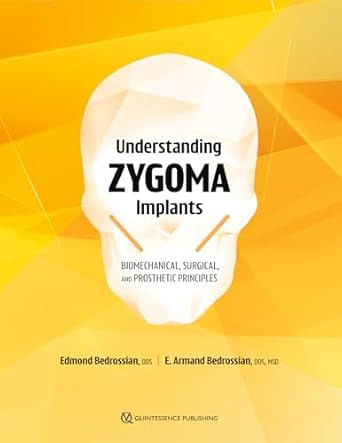 Understanding Zygoma Implants