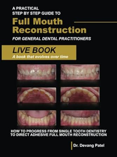 A Practical Step By Step Guide to Full Mouth Reconstruction