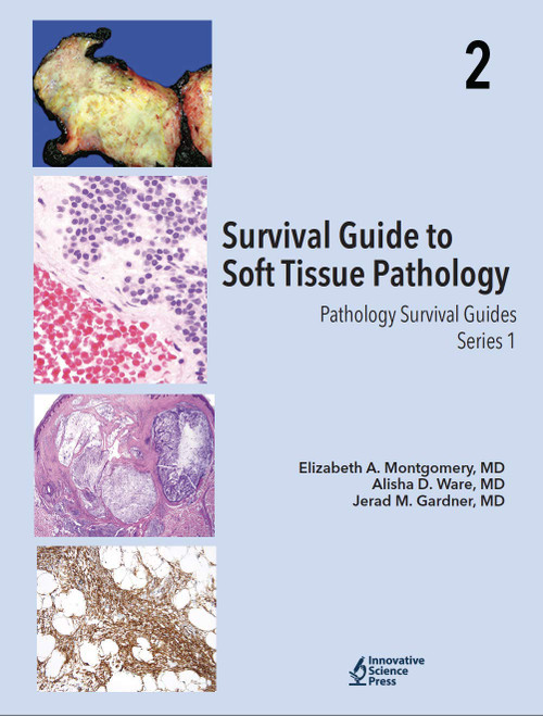 Survival Guide to Soft Tissue Pathology