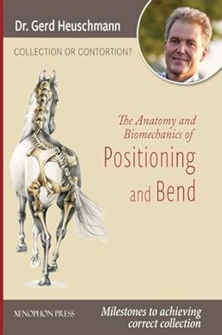 Collection or Contortion