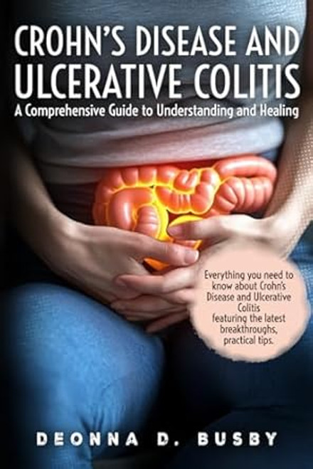 Crohn's Disease and Ulcerative Colitis A Comprehensive