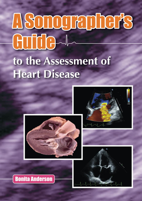 A Sonographer's Guide to the Assessment of Heart Disease