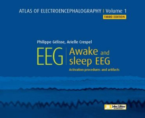 Atlas of Electroencephalography. Awake and sleep EEG. Activation