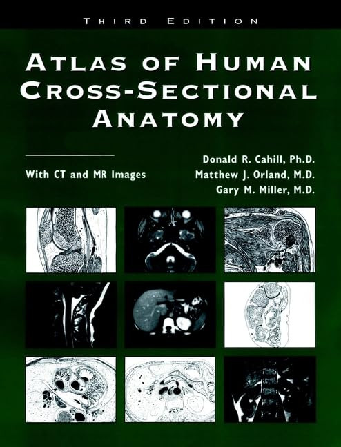 Atlas of Human Cross-Sectional Anatomy: With CT and MR Images