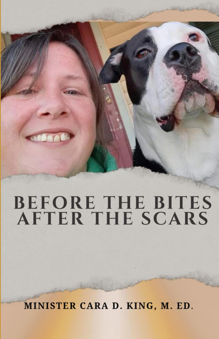 BEFORE THE BITES, AFTER THE SCARS