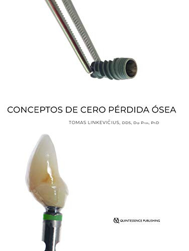 Conceptos de Cero Pérdida Ósea (Spanish Edition)