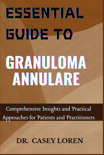 ESSENTIAL GUIDE TO GRANULOMA ANNULARE