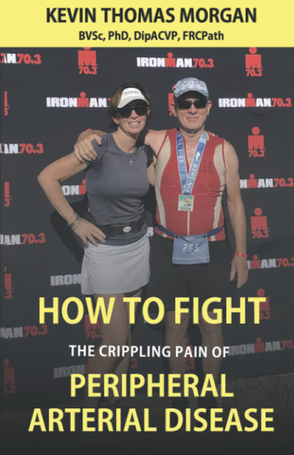 How to Fight The Crippling Pain of Peripheral Arterial Disease