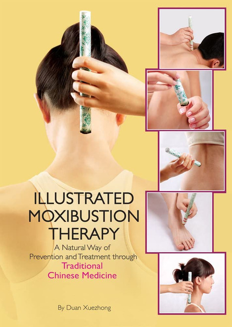 Illustrated Moxibustion Therapy: A Natural Way of Prevention and