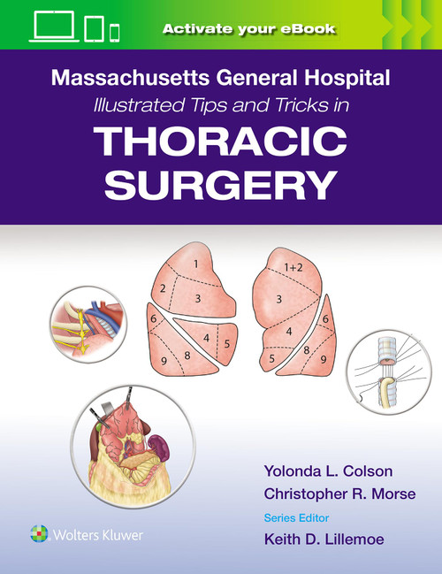 Massachusetts General Hospital Illustrated Tips and Tricks in Thoracic