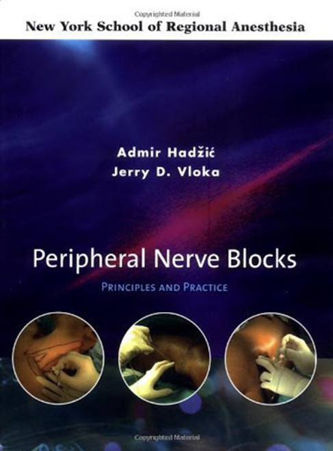 Peripheral Nerve Blocks